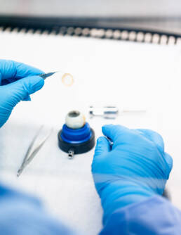 Preparing cornea tissue for keratoplasty – Medizinfotografie / Medical photography